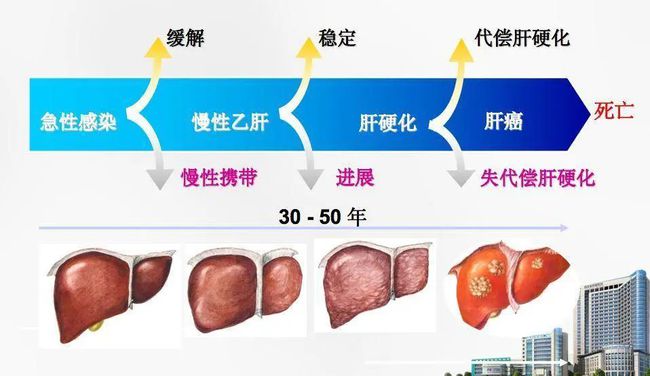 肝癌攻克最新進(jìn)展，科研突破、未來(lái)展望與希望之光